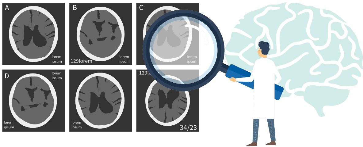 スマート脳ドックのイメージ